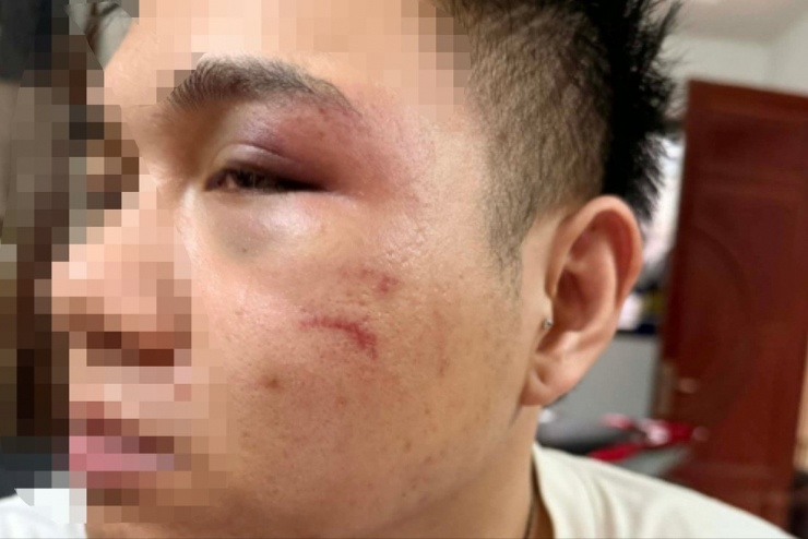 Nhân vật cung cấp.