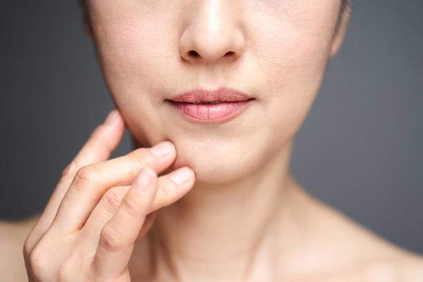 Da chảy xệ là dấu hiệu thường gặp của lão hóa và suy giảm collagen theo thời gian.