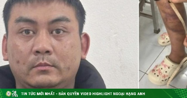 Khởi tố kẻ nhiều lần đánh đập vợ đang mang thai và con gái 13 tuổi