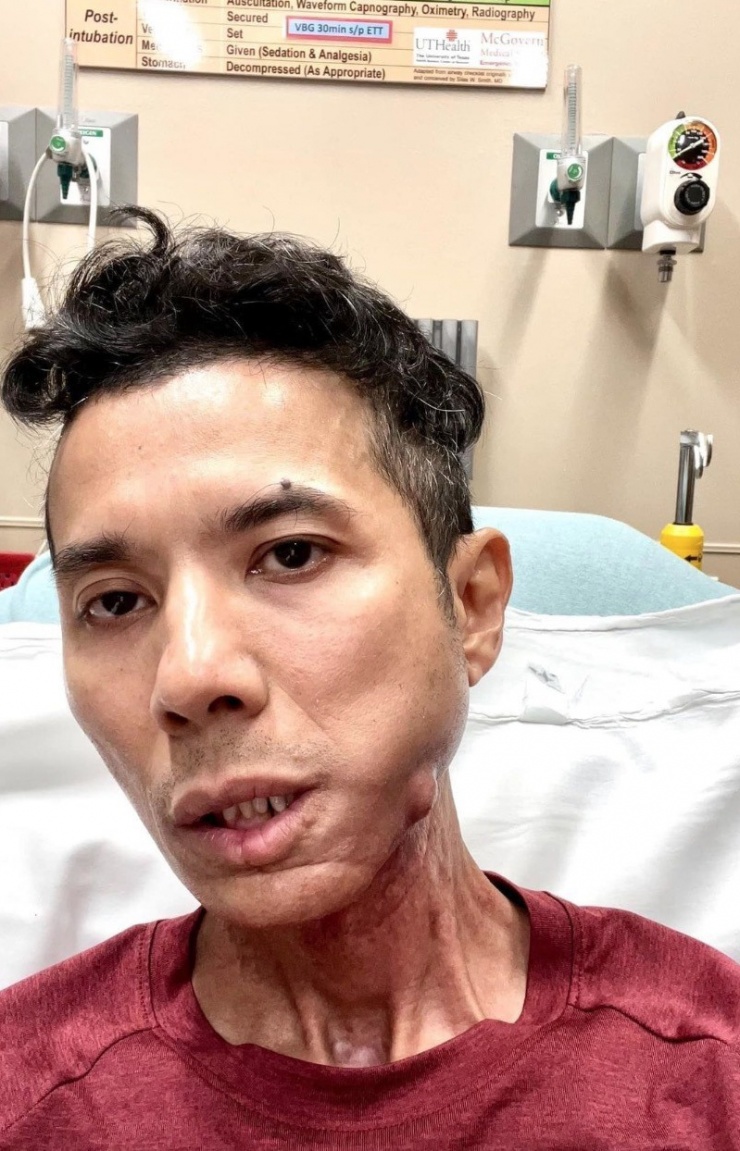 Khi đang ở đỉnh cao, Kasim Hoàng Vũ sang Mỹ định cư. Những năm cuối đời, anh chống chọi với bệnh tật và ra đi ở tuổi 46.