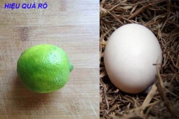 Tin tức sức khỏe - Vì sao trào ngược dạ dày, viêm loét dạ dày lại phổ biến tại Việt Nam, cách giải quyết hiệu quả lại đơn giản không ngờ