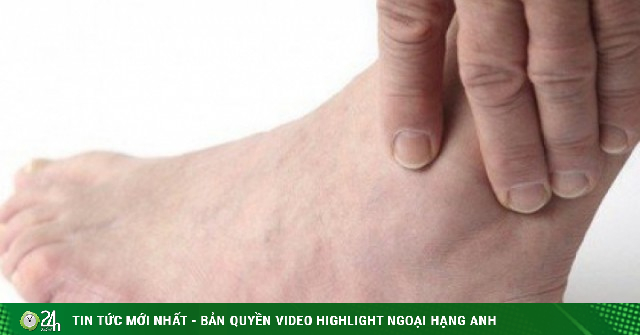 Sai lầm thường gặp chấn thương phần mềm cổ chân