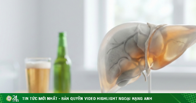 Có phải uống bia không cồn không sợ hại gan, thận?