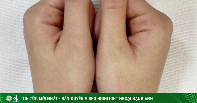 Bi hài cuộc sống của những người không thể phân biệt trái phải