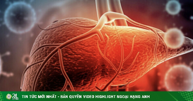 Nguy cơ ung thư từ 'sát thủ thầm lặng' gan nhiễm mỡ