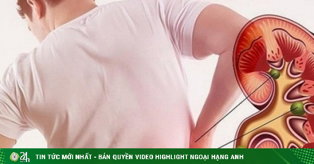 5 dấu hiệu cho thấy thận của nam giới khỏe mạnh: Bạn có bao nhiêu?