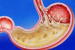  Đâu là nguyên nhân gốc rễ và giải pháp?