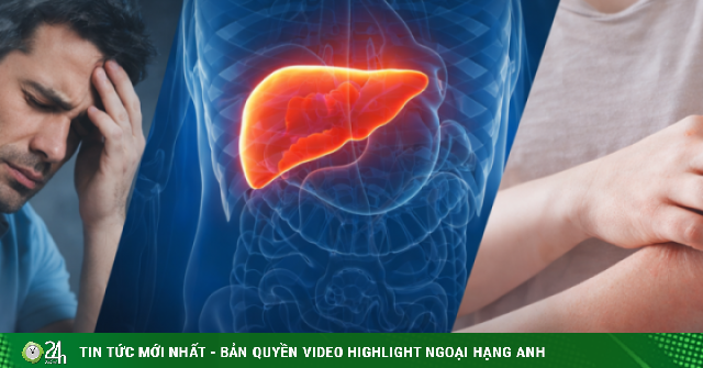 3 dấu hiệu cảnh báo cơ thể đang quá tải, sắp 'vượt ngưỡng': Đừng bỏ qua nếu xuất hiện thường xuyên