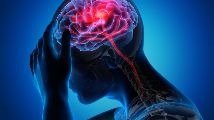 Nguy cơ đột quỵ và các biến cố tim mạch nguy hiểm khác có thể được kéo giảm nhờ các thay đổi rất nhỏ trong lối sống - Ảnh minh họa: CDC