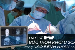 Bác sĩ FV bóc trọn khối u 2cm trong não bệnh nhân nhờ công nghệ định vị Navigation thế hệ mới