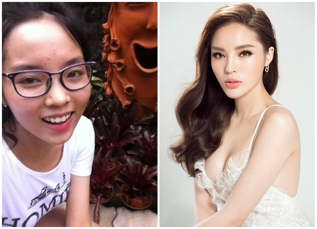 Hoa hậu Kỳ Duyên được nhận xét là "dậy thì thành công" nhất trong số các Hoa hậu Việt Nam. Thuở học sinh, cô nàng có làn da bánh mật cùng gương mặt lấm tấm mụn.