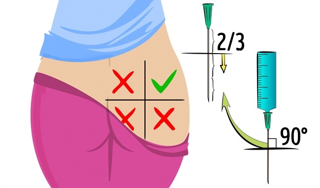 90% mọi người đều thực hiện sai 10 phương pháp sơ cứu cơ bản này - 10