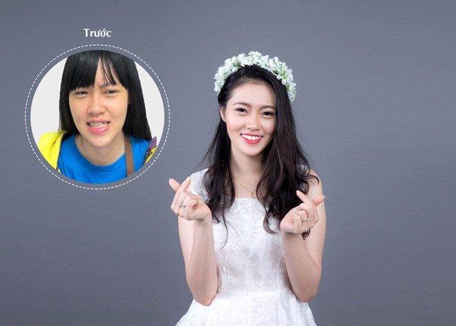 Nha khoa JW giảm giá thả ga, răng đẹp không lo giá! - 1