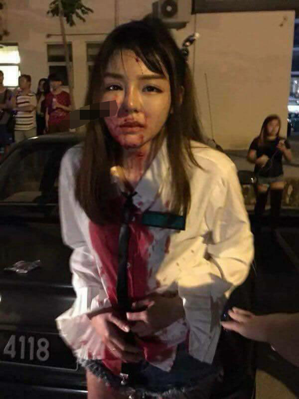 Malaysia: Thiếu nữ xinh đẹp chống cự tên cướp, bị dao cắm vào mặt - 1