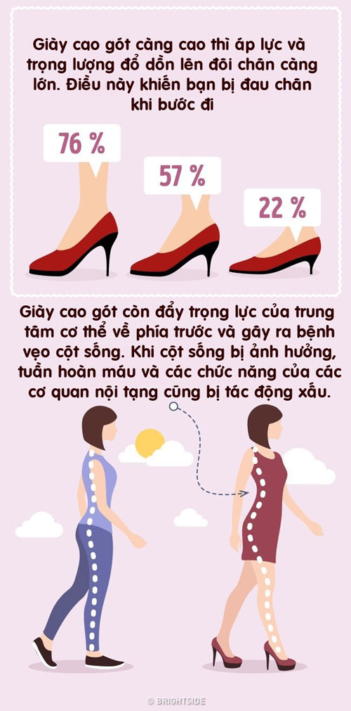 Bạn sẽ mắc những bệnh chẳng ngờ này nếu đi giày cao gót thường xuyên - 2