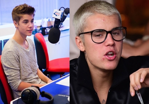 Từng là &#34;đệ nhất sát gái&#34;, ai ngờ Justin Bieber lại ra nông nỗi này? - 7