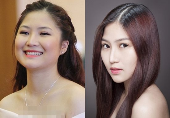 Tình cũ Trường Giang &#34;dao kéo&#34; lần 6 để có mũi Song Hee Kyo - 8