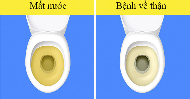 Đừng bỏ qua 7 dấu hiệu đáng báo động khi nạp quá nhiều muối vào cơ thể - 3