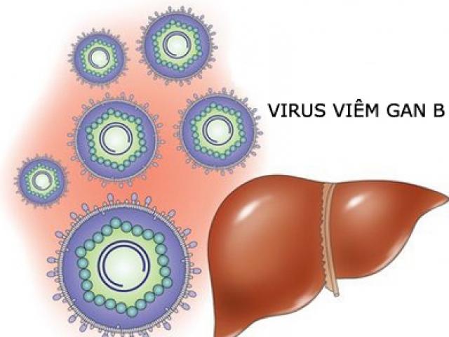 Nhiễm virut viêm gan B có nguy hiểm?