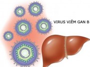 Sức khỏe đời sống - Nhiễm virut viêm gan B có nguy hiểm?