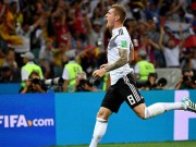 Bóng đá - Ấn tượng World Cup 24/6: SAO tuyển Đức đổ máu vì dính &quot;thiên tàn cước&quot;