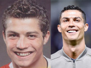 Làm đẹp - CR7, Beckham, Ronaldinho... điển trai hơn nhờ thẩm mỹ, sửa răng