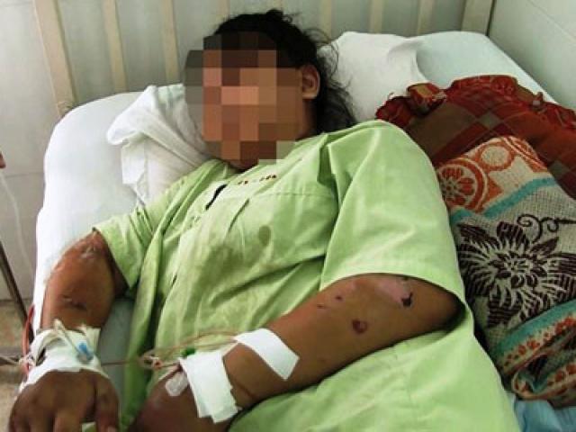 Tiết lộ chấn động từ thai phụ 18 tuổi bị tra tấn ở Bình Chánh