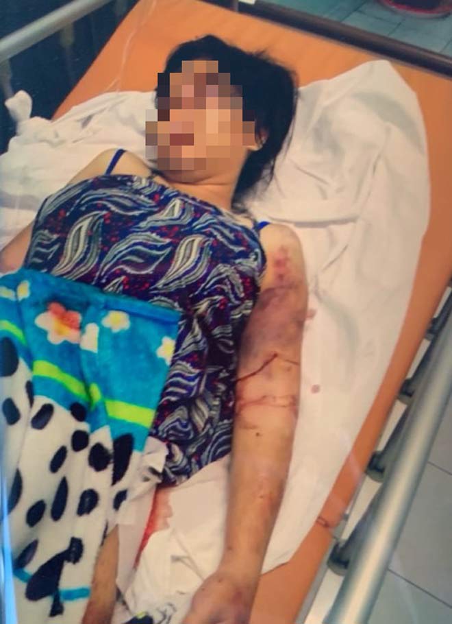 Tiết lộ chấn động từ thai phụ 18 tuổi bị tra tấn ở Bình Chánh - 1