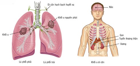 Loại quả rẻ nhất Việt Nam khiến tế bào ung thư không thể di căn - 1