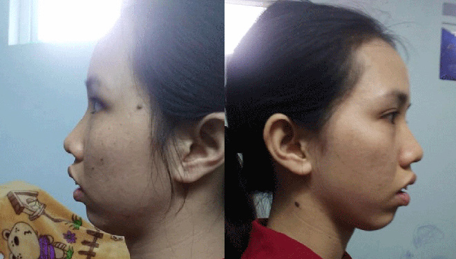 Câu nói ám ảnh từ chồng khiến mẹ một con quyết tâm đi phẫu thuật thẩm mỹ - 1