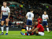 Bóng đá - Tottenham ăn đứt MU 2 đấu trường: “Đại gia” có xấu hổ thua “Gã hà tiện”?