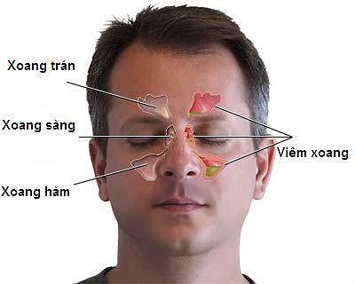 Bệnh ung thư &#39;ăn&#39; vào não có dấu hiệu chỉ từ đau đầu, nhìn kém - 1