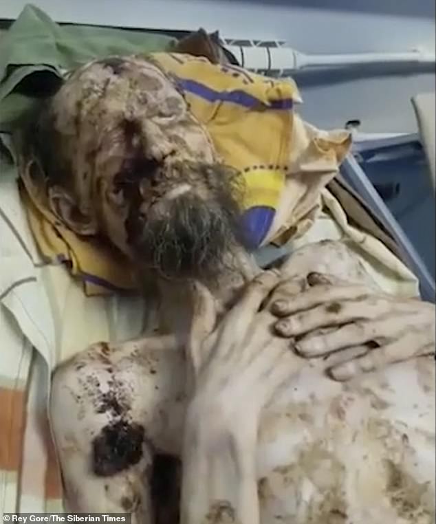 Nga: Người đàn ông trông như xác ướp, bị gấu nhốt trong hang cả tháng làm thức ăn? - 1