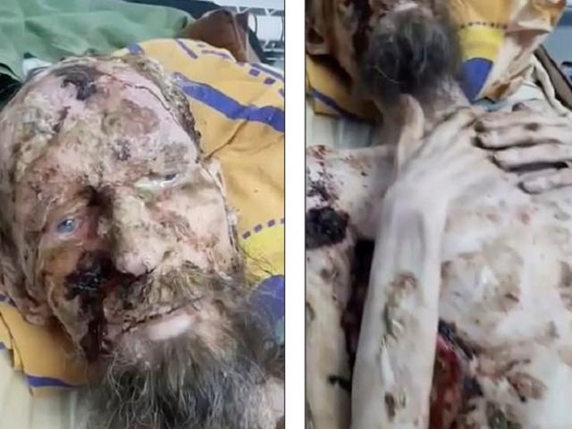 Thông tin mới về người như xác ướp ”bị gấu nhốt trong hang ở Nga” cả tháng