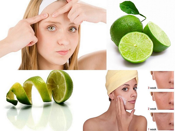 15 Cách trị mụn thâm tại nhà hiệu quả nhanh nhất cho mọi làn da - 15