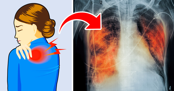 Có 5 dấu hiệu này chứng tỏ phổi của bạn đang &#34;kêu cứu&#34;, tuyệt đối không được chủ quan - 1