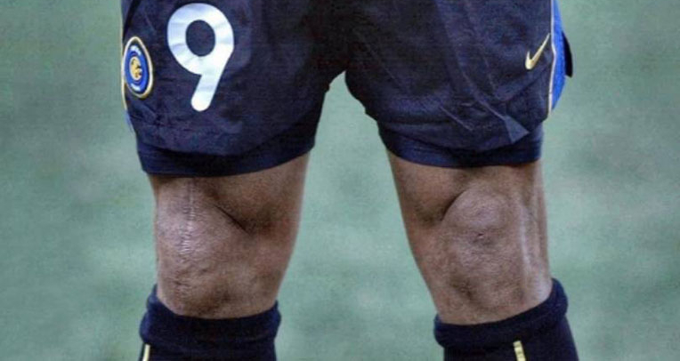 Huyền thoại Ronaldo béo: Nếu không chấn thương sẽ vĩ đại đến nhường nào? - 11