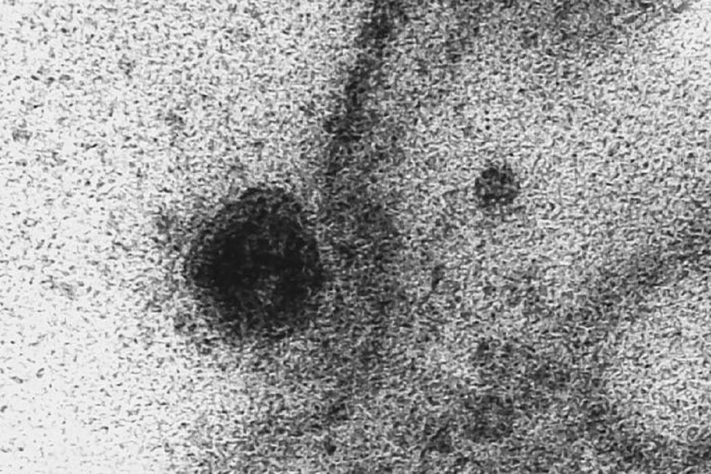 Khoảnh khắc chính xác virus SARS-CoV-2 xâm nhập&nbsp;một tế bào khỏe mạnh (Ảnh: Oswaldo Cruz Foundation)