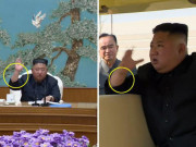 Thế giới - Báo Hàn: Ông Kim Jong-un có thể đã trải qua thủ thuật y tế