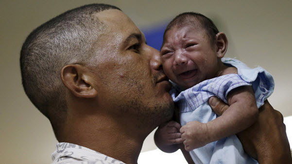 Phụ nữ mang thai trong 3 tháng đầu bị nhiễm virus Zika có nguy cơ mắc hội chứng đầu nhỏ (teo não) ở thai nhi.
