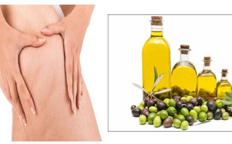 Cách trị rạn da an toàn hiệu quả nhanh nhất tại nhà - 5