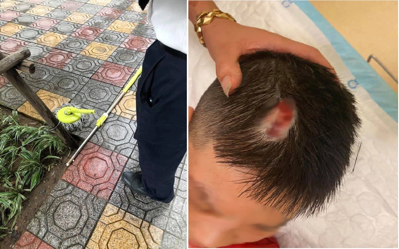 Bé trai phải nhập viện vì bị chổi lau nhà từ tầng 5 chung cư cao cấp rơi trúng đầu