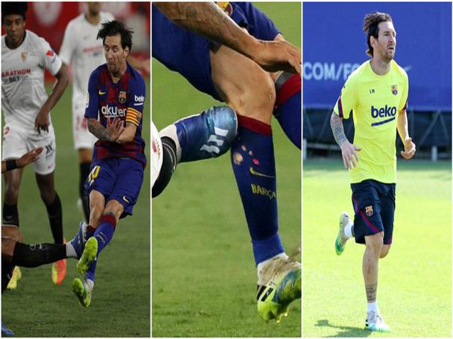 Bóng đá - Lộ lý do Messi nổi giận, đẩy ngã đối thủ: Đau lòng vết xước dài trên chân