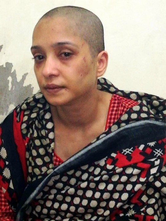 Asma Aziz sau khi bị chồng và bạn chồng hành hạ, làm nhục.
