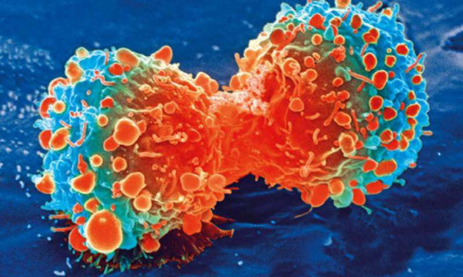 Tế bào ung thư gan - ảnh: Viện Y tế Quốc gia Mỹ