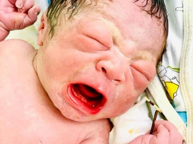 Kỳ diệu: Bé trai ở Hải Phòng chào đời với chiếc vòng tránh thai cầm chặt trên tay