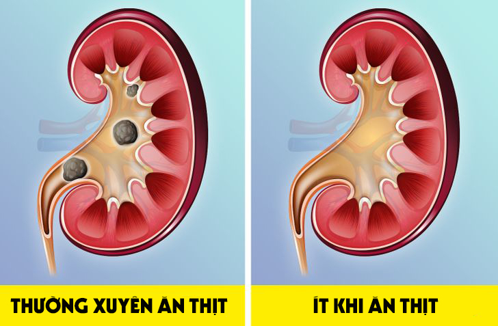 Chuyện gì sẽ xảy ra với cơ thể khi bạn ăn quá nhiều thịt? - 1