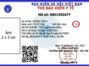 Sức khỏe đời sống - Cách đọc mã số để biết mức hưởng trên thẻ BHYT mới