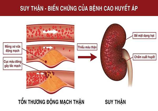 Không còn tiểu đêm, hỗ trợ bổ thận nhờ Vương Bảo Thận - 2