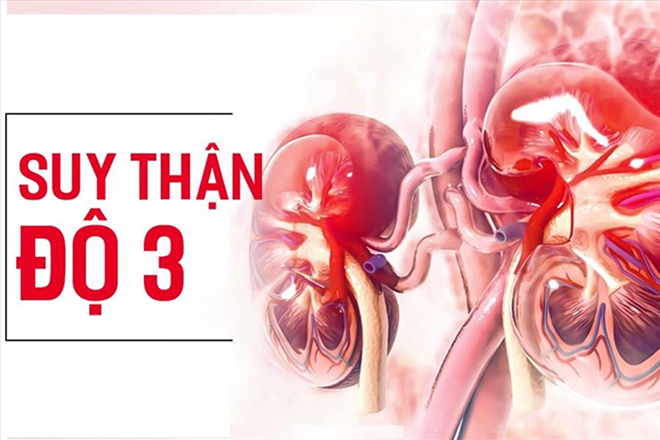 Suy thận độ 3 là giai đoạn bệnh có những tổn thương nghiêm trọng